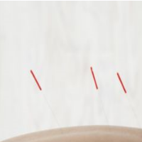 articles acupuncture